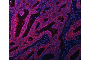 IF analysis of EIF3A using anti-EIF3A antibody (ABIN7599942).