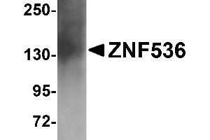 Western Blotting (WB) image for anti-Zinc Finger Protein 536 (ZNF536) (N-Term) antibody (ABIN1031687)