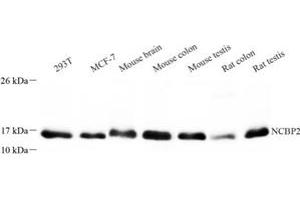 Western blot analysis of NCBP2 (ABIN7074870) at dilution of 1: 300 (NCBP2 Antikörper)