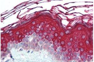 Human Skin (formalin-fixed, paraffin-embedded) stained with ALAS1 antibody ABIN290712 at 5 ug/ml followed by biotinylated goat anti-rabbit IgG secondary antibody ABIN481713, alkaline phosphatase-streptavidin and chromogen. (ALAS1 Antikörper  (AA 480-530))