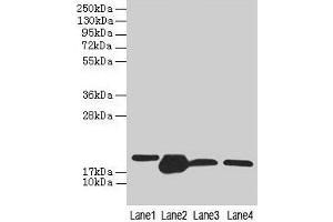 Western blot All lanes: DHRS3 antibody at 0. (DHRS3 Antikörper  (AA 30-169))
