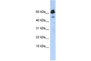 WB Suggested Anti-ABAT Antibody Titration: 0. (ABAT Antikörper  (Middle Region))