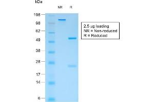 SDS-PAGE Analysis Purified CD44v4 Mouse Recombinant Monoclonal Antibody (rCD44v4/1219). (Rekombinanter CD44 Antikörper)