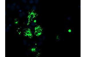 Anti-CAMLG mouse monoclonal antibody (ABIN2455753) immunofluorescent staining of COS7 cells transiently transfected by pCMV6-ENTRY CAMLG (RC218292). (CAMLG Antikörper)