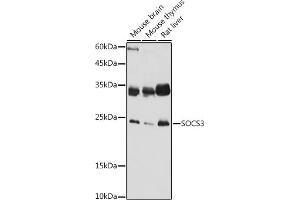 Western blot analysis of extracts of various cell lines, using SOCS3 antibody (ABIN3015316, ABIN3015317, ABIN5663764 and ABIN6213984) at 1:1000 dilution. (SOCS3 Antikörper  (C-Term))