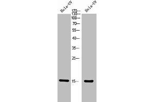 Western Blot analysis of Hela+UV 5' cells using Phospho-Histone H2A (T121) Polyclonal Antibody. (HIST1H2AG/HIST1H2AB/HIST1H2AD/HIST1H2AH/HIST2H2AA3/HIST3H2A (pThr121) Antikörper)
