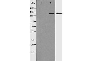 Western blot analysis of Collagen III expression in HT1080 Whole cell lysate.