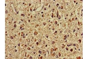 Immunohistochemistry of paraffin-embedded human glioma using ABIN7159696 at dilution of 1:100 (IMMT Antikörper  (AA 76-215))