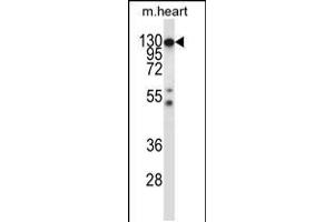 Western blot analysis in mouse heart tissue lysates (35ug/lane). (CSF1R Antikörper  (C-Term))