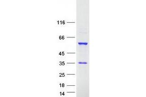 RBM23 Protein (Transcript Variant 2) (Myc-DYKDDDDK Tag)