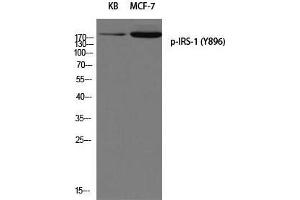 Western Blot (WB) analysis of KB MCF-7 using p-IRS-1 (Y896) antibody. (IRS1 Antikörper  (pTyr896))