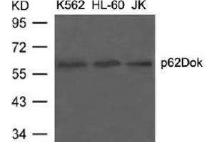 Image no. 3 for anti-Docking Protein 1, 62kDa (Downstream of tyrosine Kinase 1) (DOK1) (Tyr398) antibody (ABIN197539) (DOK1 Antikörper  (Tyr398))