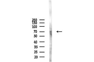 Western blot analysis of lysates from  cells(starvation,24h treatment), using SLC40 Antibody at 1/1000 dilution.