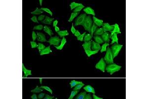 Immunofluorescence analysis of HeLa cells using C4BPB Polyclonal Antibody (C4BPB Antikörper)