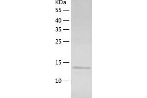 BCL2A1 Protein (AA 1-152) (His tag)