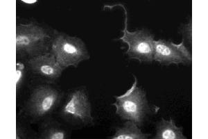 Immunofluorescent staining of U2OS (ATCC HTB-96) cells. (FAK Antikörper  (AA 354-533))