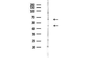 Western blot analysis of lysates from COLO205 cells(starvation 24h treatment), using Phospho-SGK1 (Ser78) Antibody at 1/1000 dilution.
