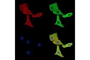 ABIN7095945 and ABIN7100007 staining Hela cells by IF/ICC. (RASGRP4 Antikörper)
