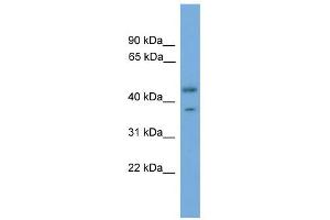 WB Suggested Anti-PRPSAP2 Antibody Titration: 0. (PRPSAP2 Antikörper  (Middle Region))
