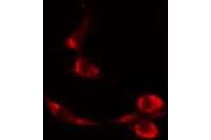 ABIN6277088 staining  Hela cells by IF/ICC. (Progesterone Receptor Antikörper  (Internal Region))