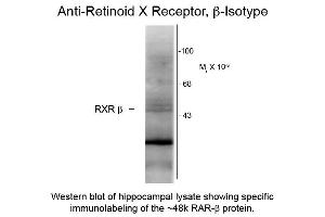 Western blot of Anti-Retinoid X Receptor beta (Mouse) Antibody - 200-301-E27 Western Blot of Mouse anti-Retinoid X Receptor beta antibody.