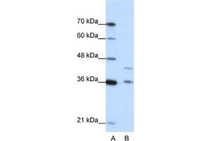 Western Blotting (WB) image for anti-Naked Cuticle Homolog 2 (NKD2) antibody (ABIN2462383) (NKD2 Antikörper)