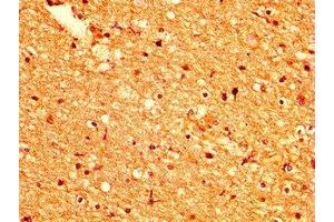 IHC image of ABIN7164465 diluted at 1:500 and staining in paraffin-embedded human brain tissue performed on a Leica BondTM system. (GPR158 Antikörper  (AA 882-1003))