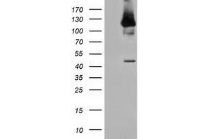 Western Blotting (WB) image for anti-Microtubule Associated Monoxygenase, Calponin and LIM Domain Containing 1 (MICAL1) antibody (ABIN1499466)