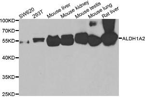 Western blot analysis of extracts of various cell lines, using ALDH1A2 antibody (ABIN5975580) at 1/1000 dilution.
