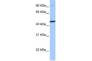 WB Suggested Anti-GBP4 Antibody Titration: 0. (GBP4 Antikörper  (Middle Region))