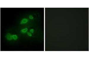 Immunofluorescence (IF) image for anti-CUB Domain Containing Protein 1 (CDCP1) (AA 691-740) antibody (ABIN2889762) (CDCP1 Antikörper  (AA 691-740))