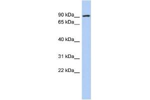 WB Suggested Anti-ALDH18A1 Antibody Titration: 0. (P5CS Antikörper  (N-Term))