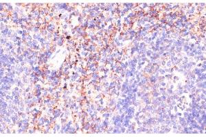 Immunohistochemistry of paraffin-embedded Mouse spleen using RAP1A Polyclonal Antibody at dilution of 1:100 (40x lens).