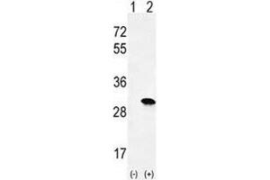 Western blot analysis of H-RAS antibody and 293 cell lysate either nontransfected (Lane 1) or transiently transfected (2) with the HRAS gene. (HRAS Antikörper  (AA 146-176))