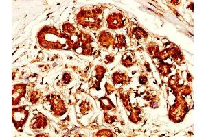 Immunohistochemistry (IHC) image for anti-Mesothelin (MSLN) (AA 37-598) antibody (ABIN7159428)