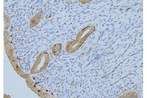ABIN6275548 at 1/100 staining Human uterus tissue by IHC-P.