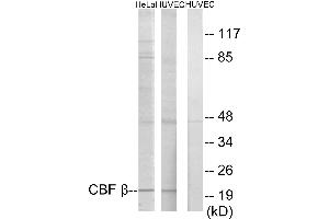 Immunohistochemistry analysis of paraffin-embedded human heart tissue using CBF β antibody. (CBFB Antikörper)