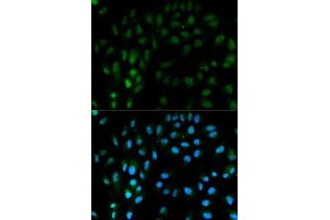Immunofluorescence analysis of MCF-7 cells using TFPI antibody. (TFPI Antikörper  (AA 29-224))