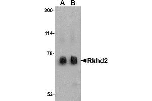 Western Blotting (WB) image for anti-Mex-3 Homolog C (C. Elegans) (MEX3C) (C-Term) antibody (ABIN1030621) (MEX3C Antikörper  (C-Term))