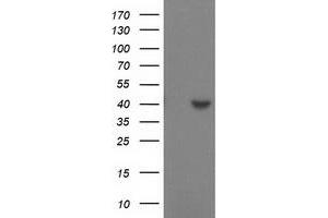Western Blotting (WB) image for anti-Sulfotransferase Family, Cytosolic, 1C, Member 2 (SULT1C2) antibody (ABIN1501231) (SULT1C2 Antikörper)