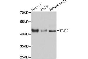 Western blot analysis of extracts of various cell lines, using TDP2 Antibody (ABIN5999024) at 1:3000 dilution. (TDP2 Antikörper)