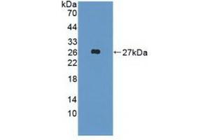 Detection of Recombinant FGF19, Human using Polyclonal Antibody to Fibroblast Growth Factor 19 (FGF19) (FGF19 Antikörper  (AA 4-216))