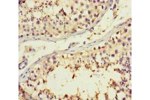 Immunohistochemistry (IHC) image for anti-UDP-Gal:betaGlcNAc beta 1,4- Galactosyltransferase, Polypeptide 3 (B4GALT3) (AA 34-393) antibody (ABIN7145392)