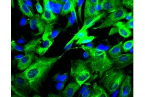 Immunofluorescent staining of SK-N-SH cells (Human neuroblastoma, ATCC HTB-11) (right).