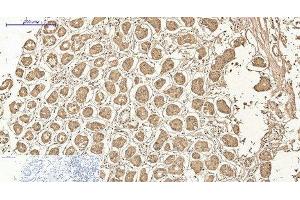 Immunohistochemistry of paraffin-embedded Human stomach tissue using AMACR Monoclonal Antibody at dilution of 1:200. (AMACR Antikörper)