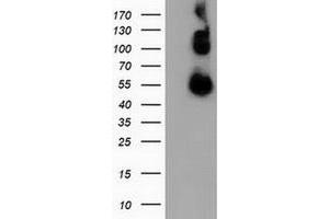 Western Blotting (WB) image for anti-Calcium Binding and Coiled-Coil Domain 2 (CALCOCO2) antibody (ABIN1497077) (CALCOCO2 Antikörper)