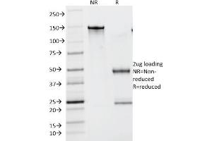 SDS-PAGE Analysis Purified Lambda Light Chain Monoclonal Antibody (N10/2). (IgL Antikörper)