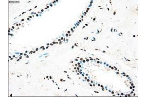 Image no. 4 for anti-TYRO3 Protein Tyrosine Kinase (TYRO3) antibody (ABIN1501605)