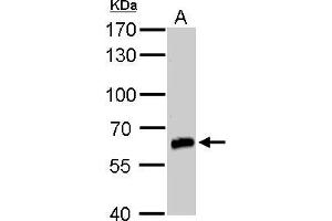 WB Image GAD67 antibody detects GAD67 protein by western blot analysis.