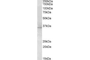 ABIN571175 (2µg/ml) staining of Mouse Eye lysate (35µg protein in RIPA buffer). (RDH5 Antikörper  (AA 19-31))